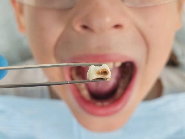 Best Pediatric Emergency Dentist in Dana Point, CA